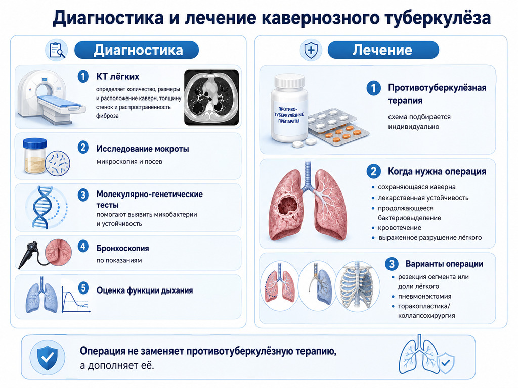 Диагностика и лечение кавернозного туберкулёза: КТ, анализ мокроты, препараты и хирургическая операция