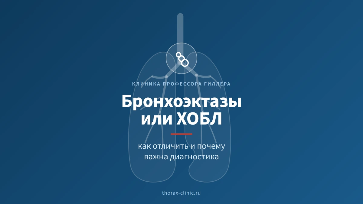 Бронхоэктазы или ХОБЛ: как отличить и почему важна диагностика