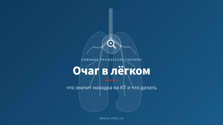 Очаг (узел) в лёгком на КТ: что это значит и что делать
