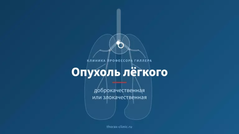 Доброкачественная или злокачественная опухоль лёгкого: как отличить