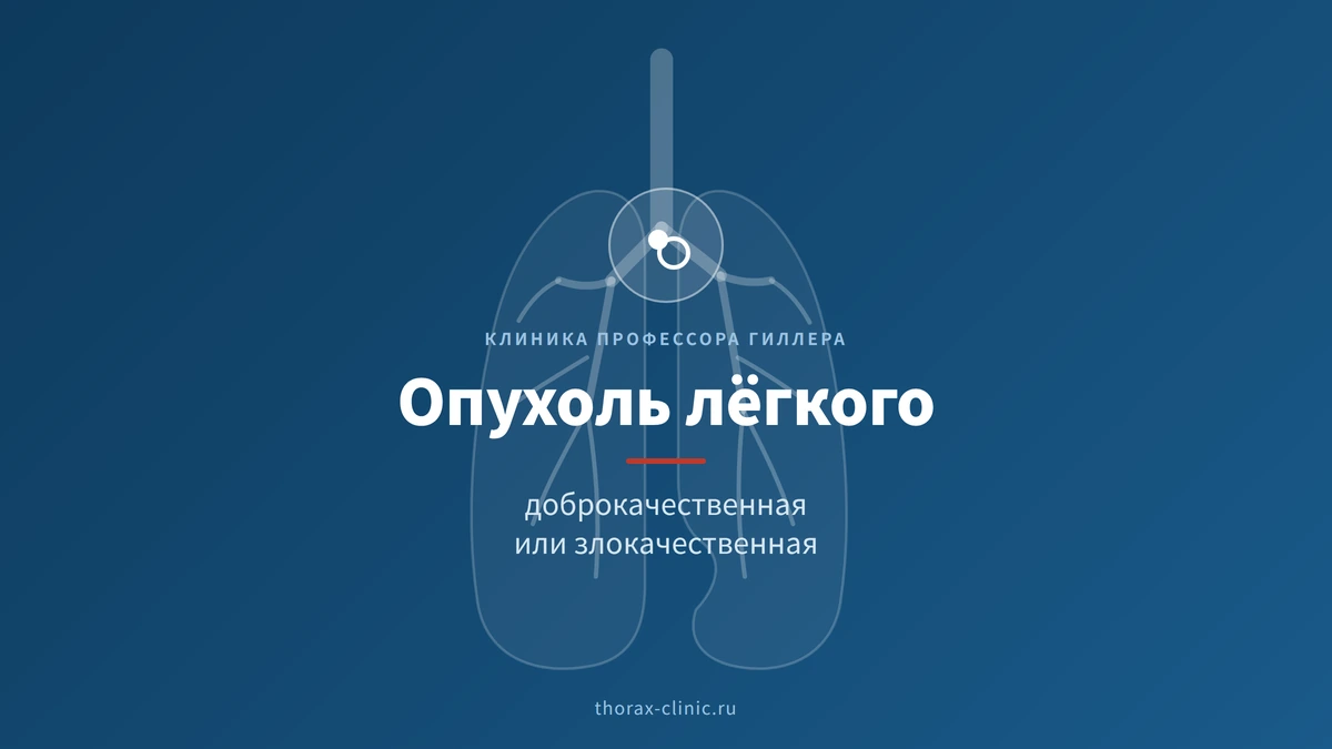 Доброкачественные и злокачественные опухоли лёгких: ключевые отличия