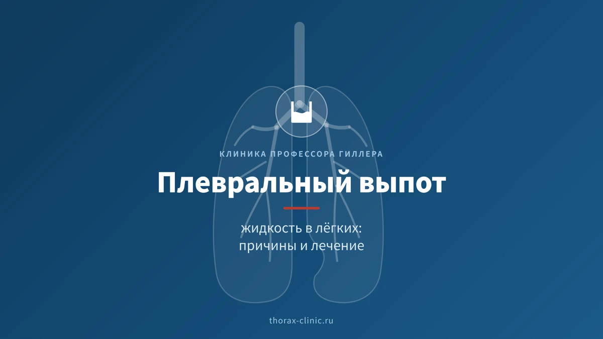 Плевральный выпот (жидкость в лёгких): причины, диагностика и лечение