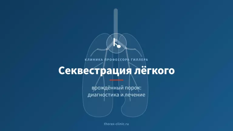 Секвестрация лёгкого: врождённый порок, диагностика и лечение