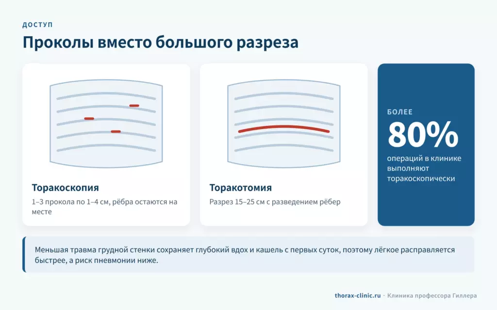 Доступ при торакоскопии и торакотомии: 1–3 прокола по 1–4 см против разреза 15–25 см