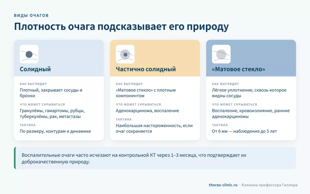 Виды очагов в лёгком на КТ: солидный, частично солидный и по типу матового стекла