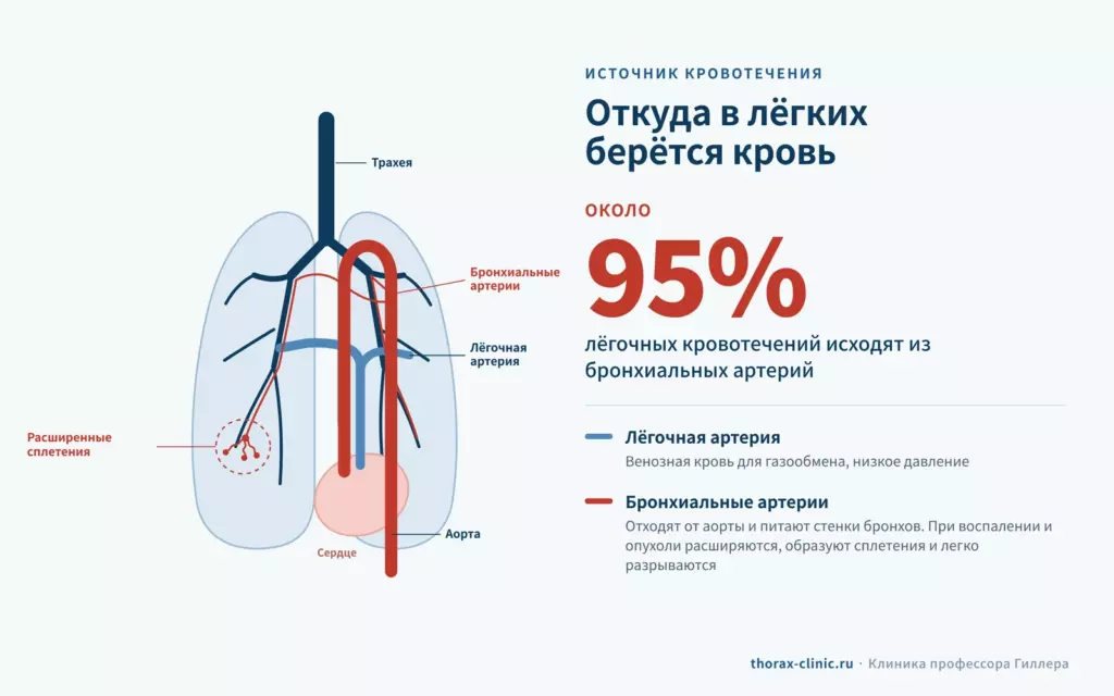 Схема кровоснабжения лёгких: около 95% лёгочных кровотечений исходят из бронхиальных артерий, отходящих от аорты