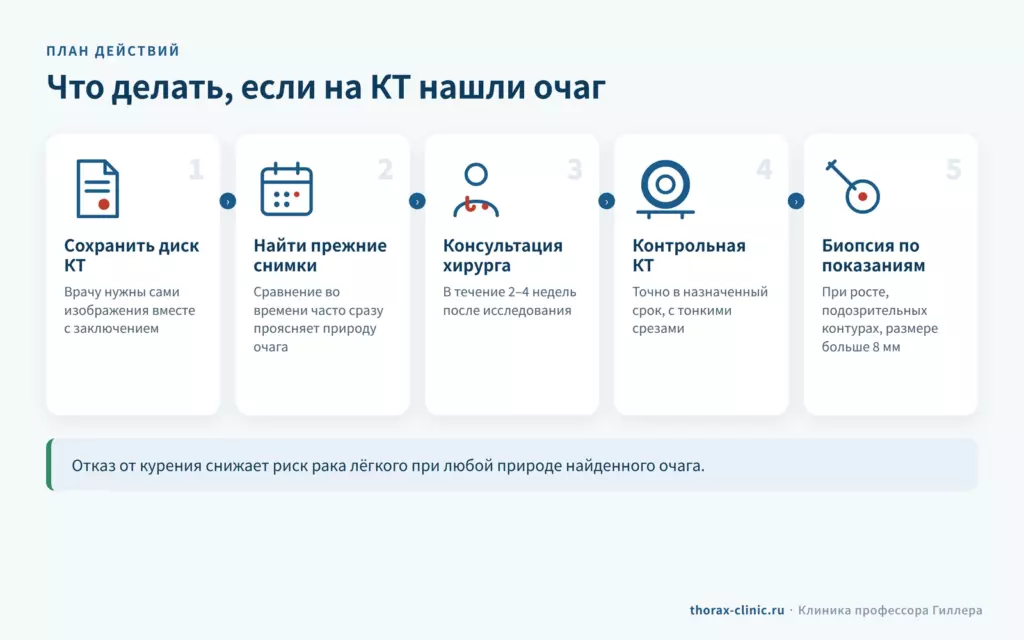 Что делать, если на КТ нашли очаг в лёгком: сохранить диск, найти прежние снимки, консультация хирурга, контрольная КТ, биопсия по показаниям
