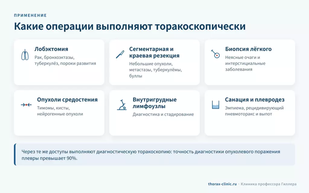Операции, которые выполняют торакоскопически: лобэктомия, резекции лёгкого, биопсия, удаление опухолей средостения и лимфоузлов, плевродез