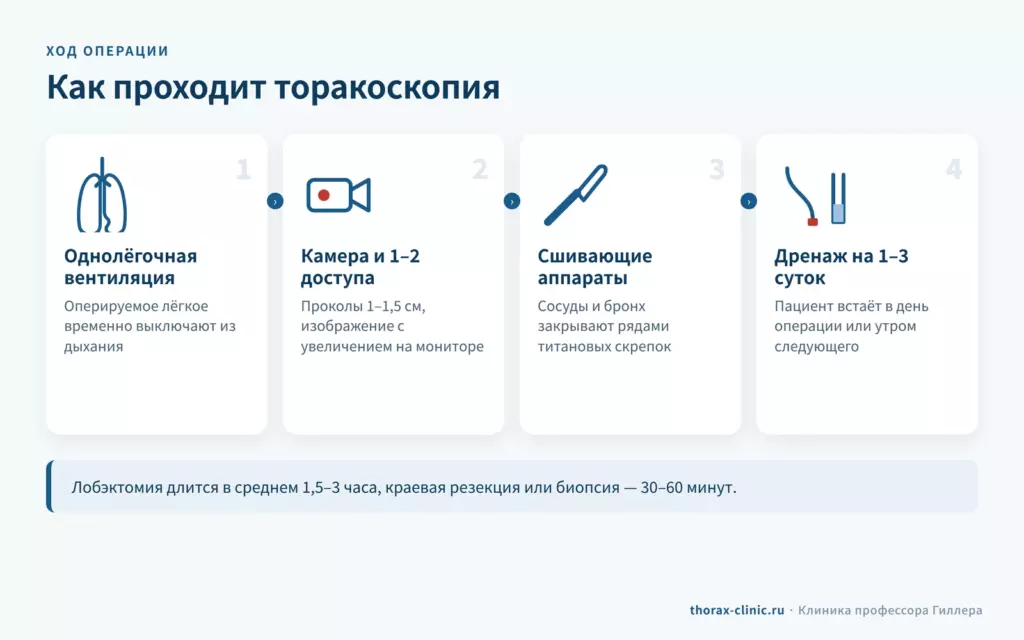 Этапы торакоскопической операции: однолёгочная вентиляция, камера и проколы, сшивающие аппараты, дренаж на 1–3 суток